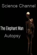Watch Science Channel Elephant Man Autopsy M4ufreemovies