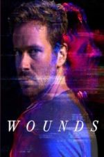 Watch Wounds M4ufreemovies
