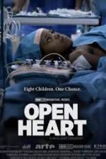 Watch Open Heart M4ufreemovies