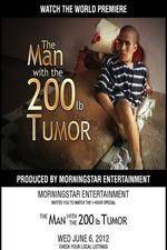 Watch The Man With The 200lb Tumor M4ufreemovies