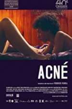 Watch Acné M4ufreemovies